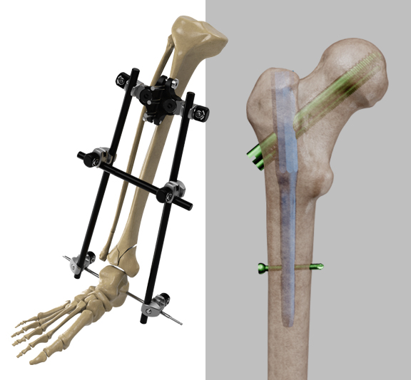Medikal Cihaz